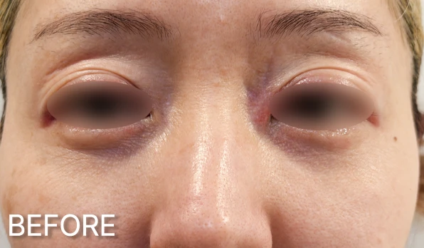 before_image