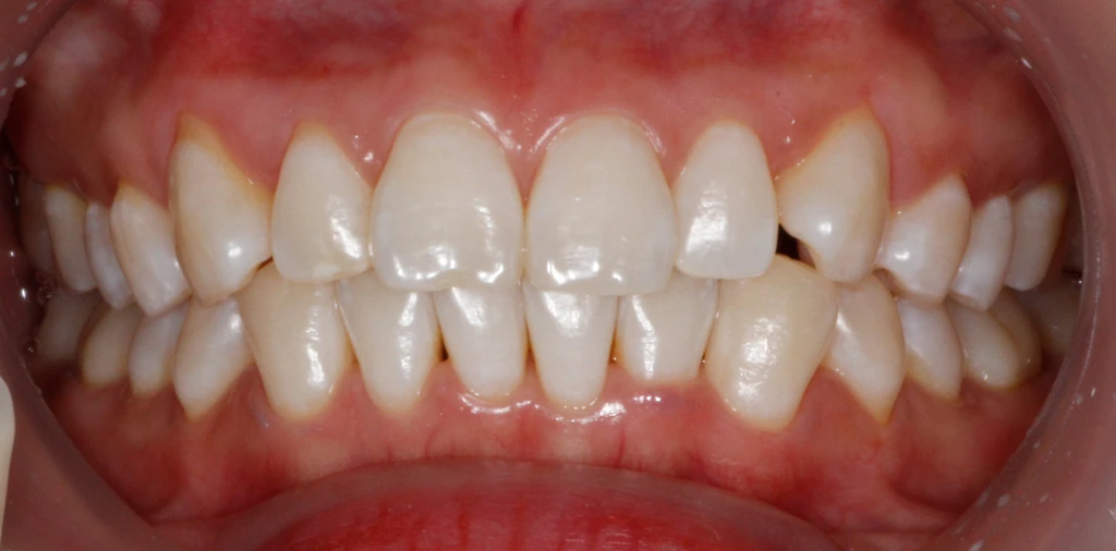 before_image