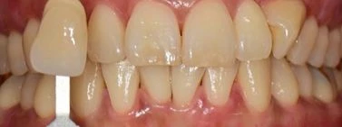 before_image