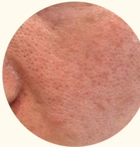 before_image