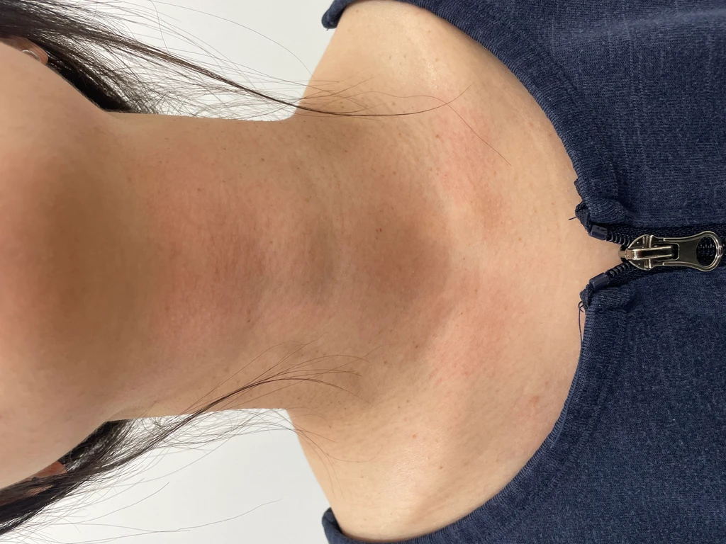 before_image