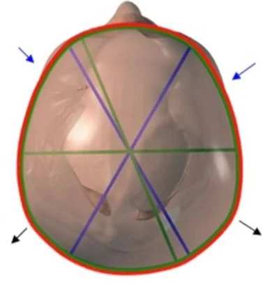 before_image
