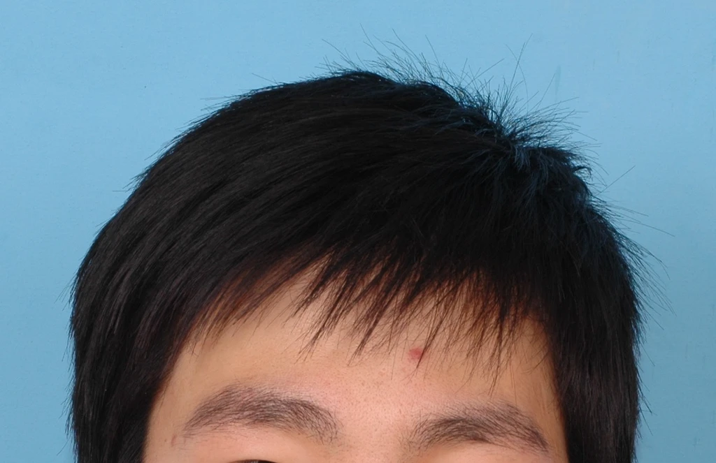 before_image