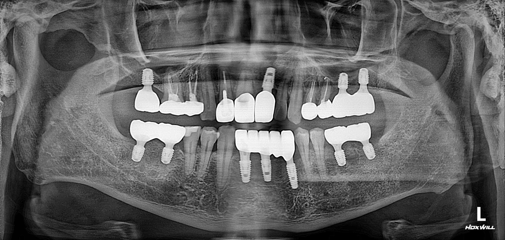 before_image