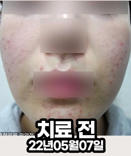 before_image