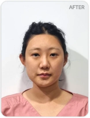 before_image