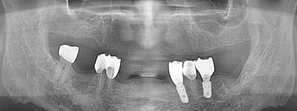 before_image