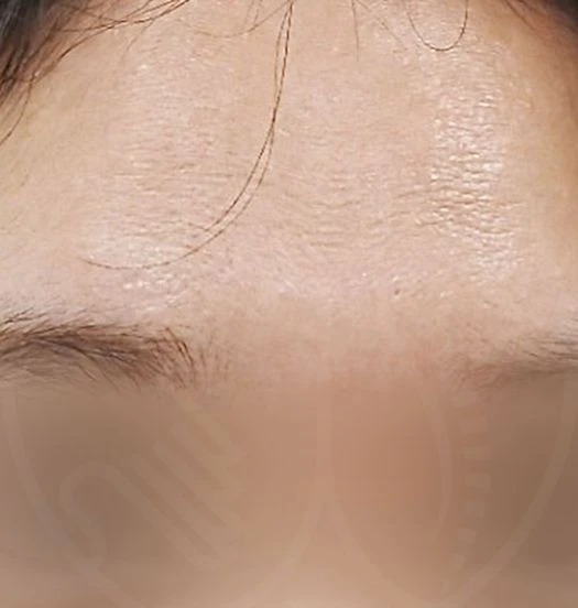 before_image