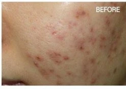 before_image