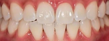 before_image