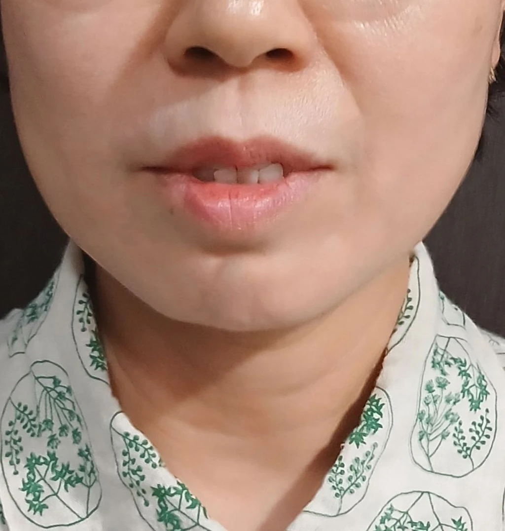 before_image