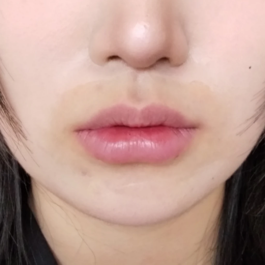 before_image
