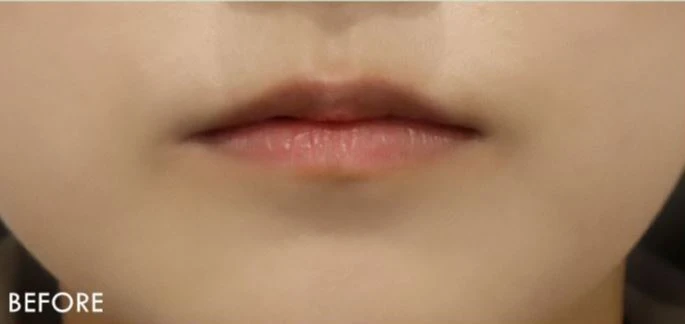before_image