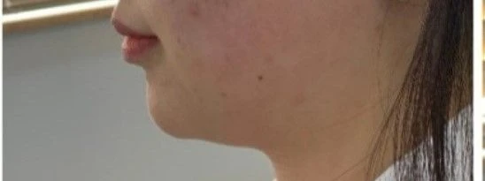 before_image