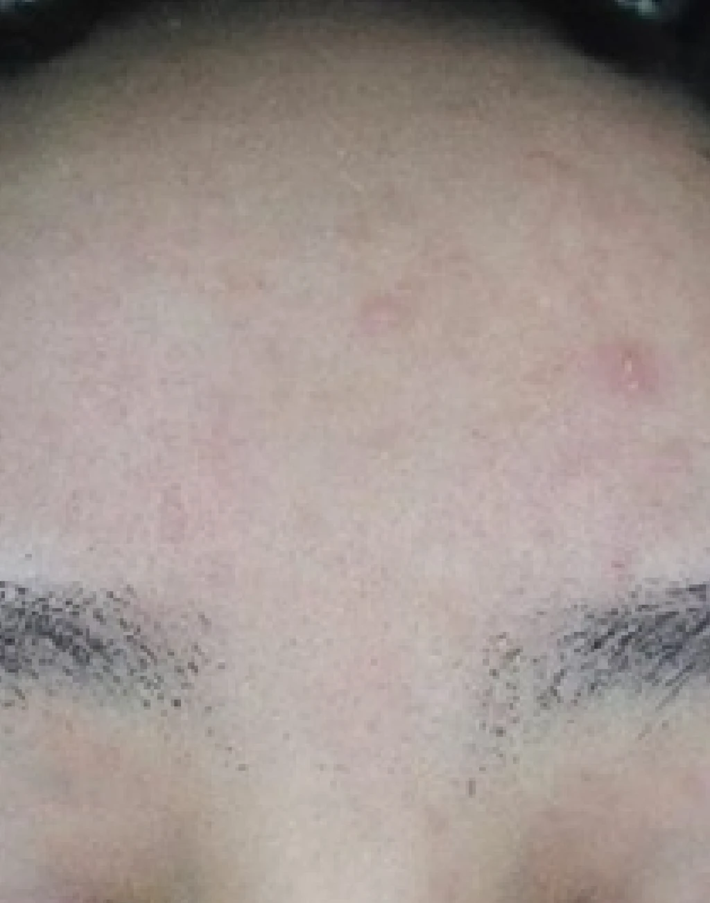 before_image