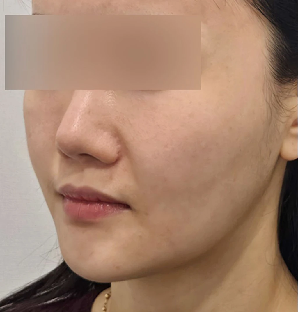 before_image
