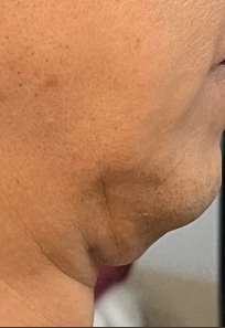 before_image