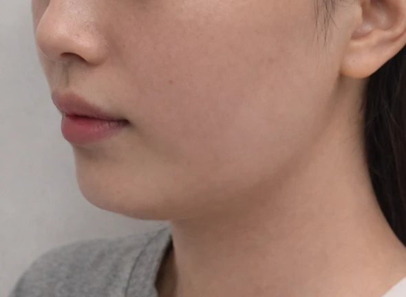 before_image