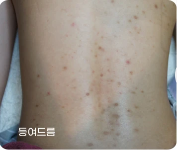 before_image