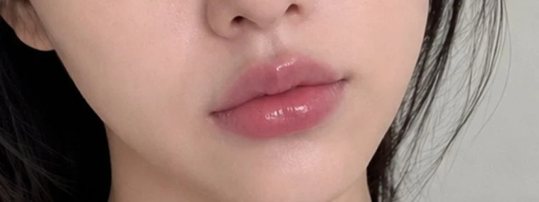 before_image