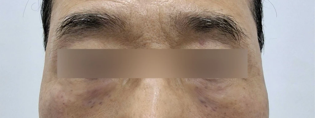 before_image