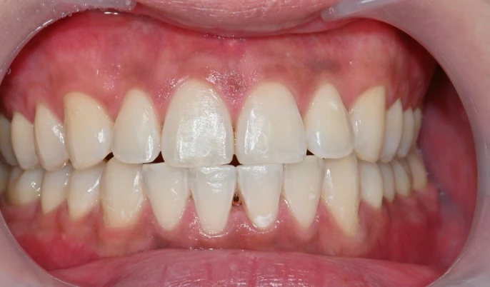 before_image