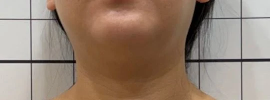 before_image