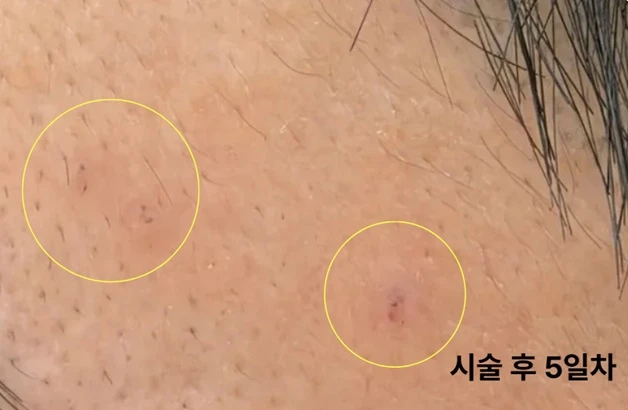 before_image