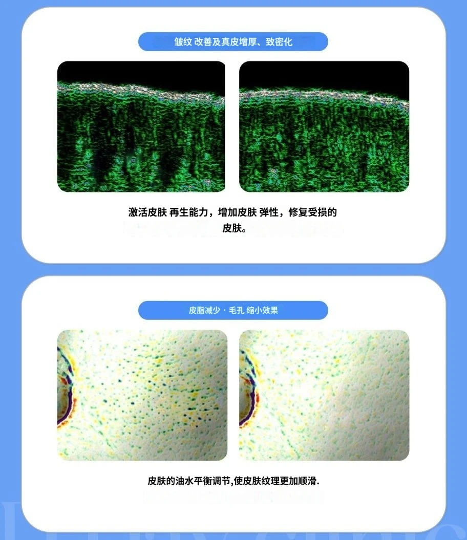 treatmentIntroduction