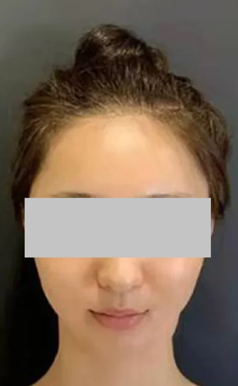 before_image