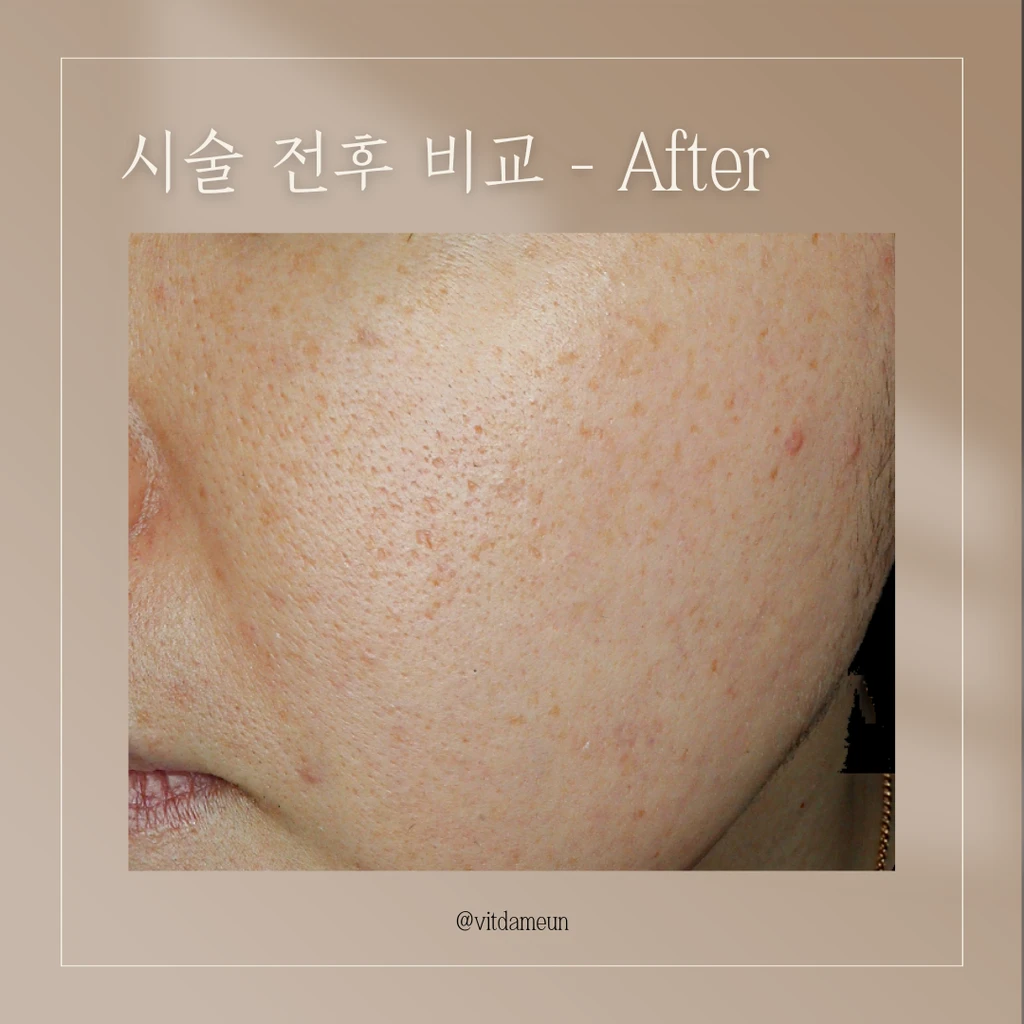 before_image