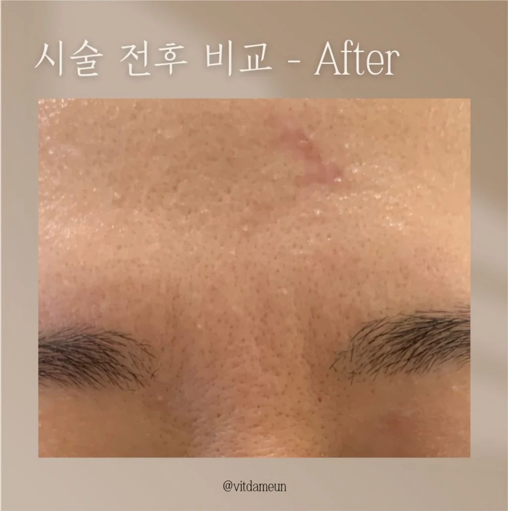 before_image