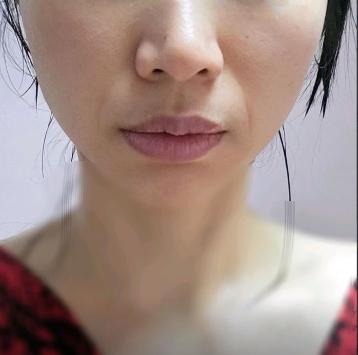 before_image