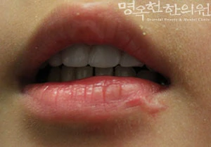 before_image