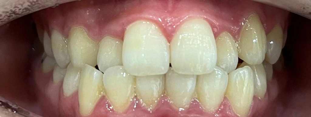 before_image