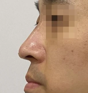 before_image