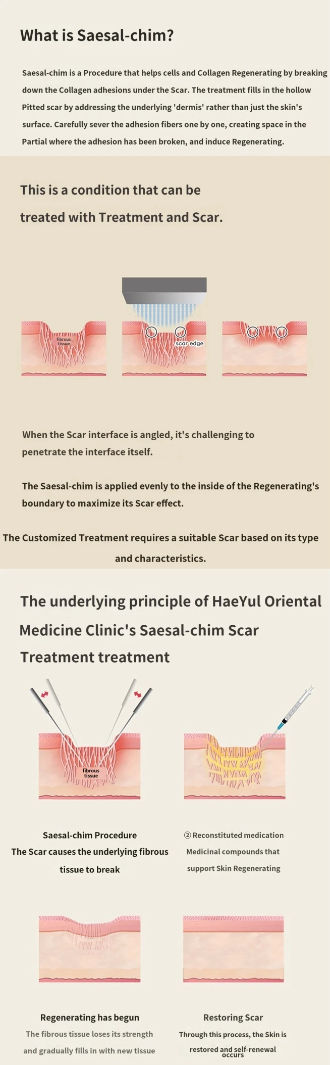 treatmentIntroduction