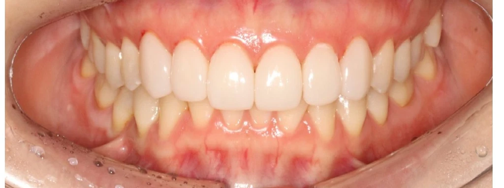 before_image
