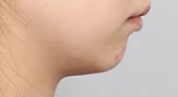 before_image