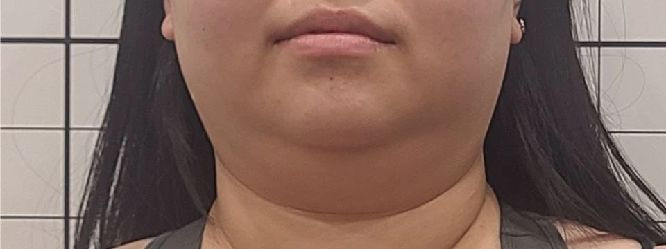 before_image