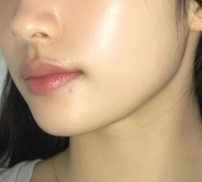 before_image