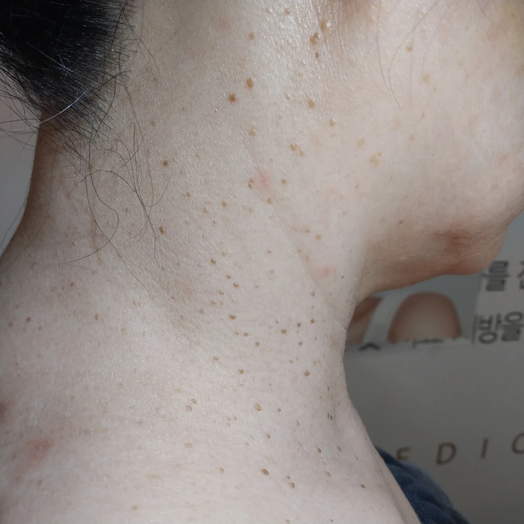 before_image