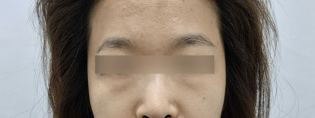 before_image