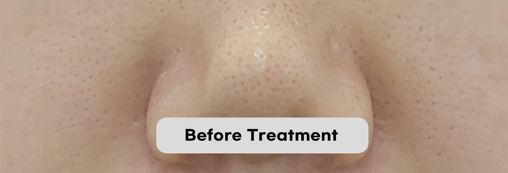 before_image