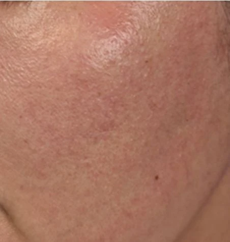 before_image