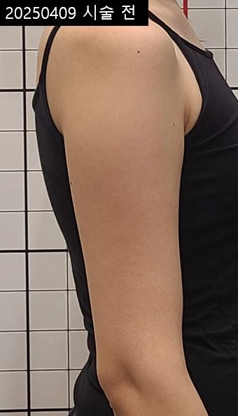 before_image