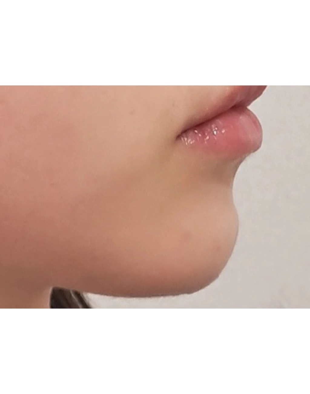 before_image