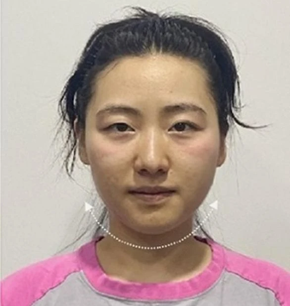 before_image