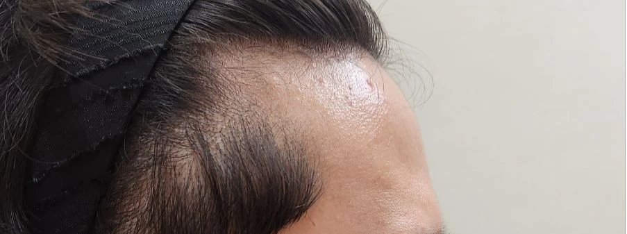 before_image