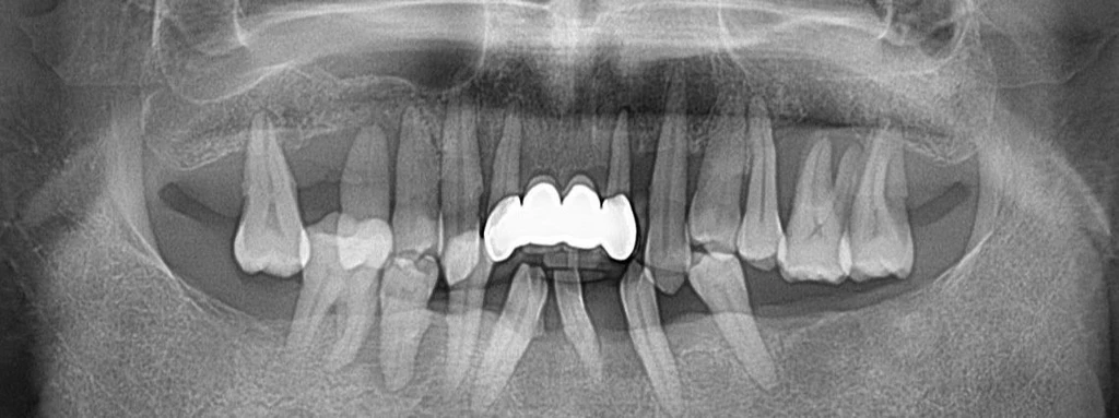before_image